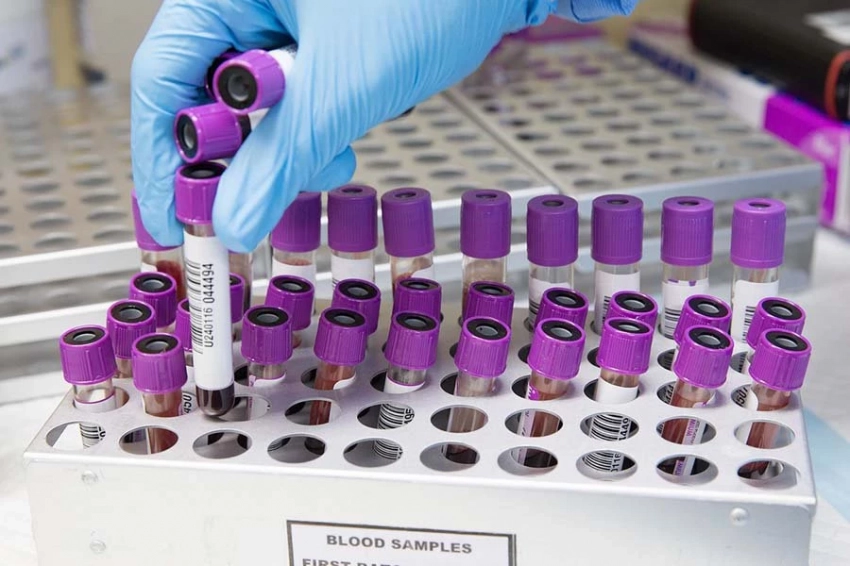 Холестерин в минусе, глюкоза в плюсе: как меняются показатели здоровья поколений