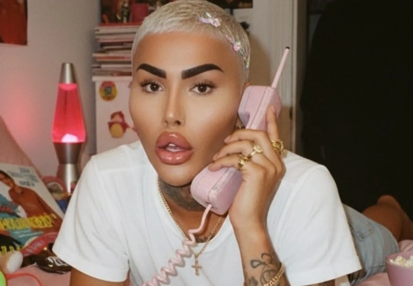 "Король губ" Джордан Парк умер в 34 года после очередной бьюти-процедуры